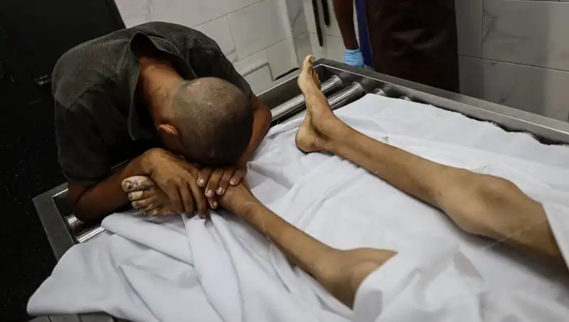 Gazze’de Açlıktan Hayatını Kaybeden Çocuklar: Acı Gerçeği Halka Arz Ediyoruz
