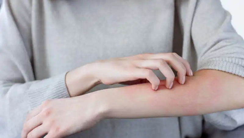 Cilt Kanseri Tehlikesi: Gözden Kaçırılan İki Belirtiyi Dermatolog Açıkladı